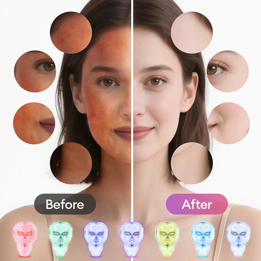 Masque LED Facial 7 Couleurs — Anti-Acné & Anti-Rides à Domicile